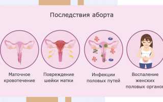 Последствия аборта