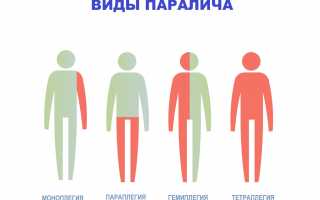 Плегия