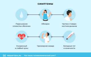 Гиповолемический шок